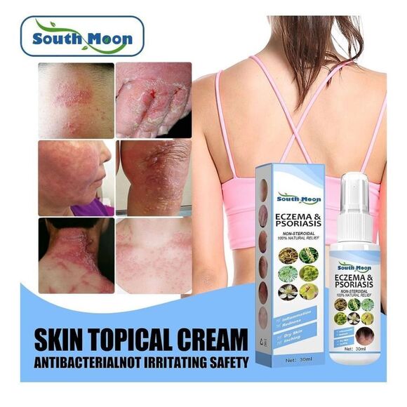 New Seborrheic Dermatitis Spray, Psoriasis Cream, Scalp Cream for Comfort and Re - Picture 6 of 7